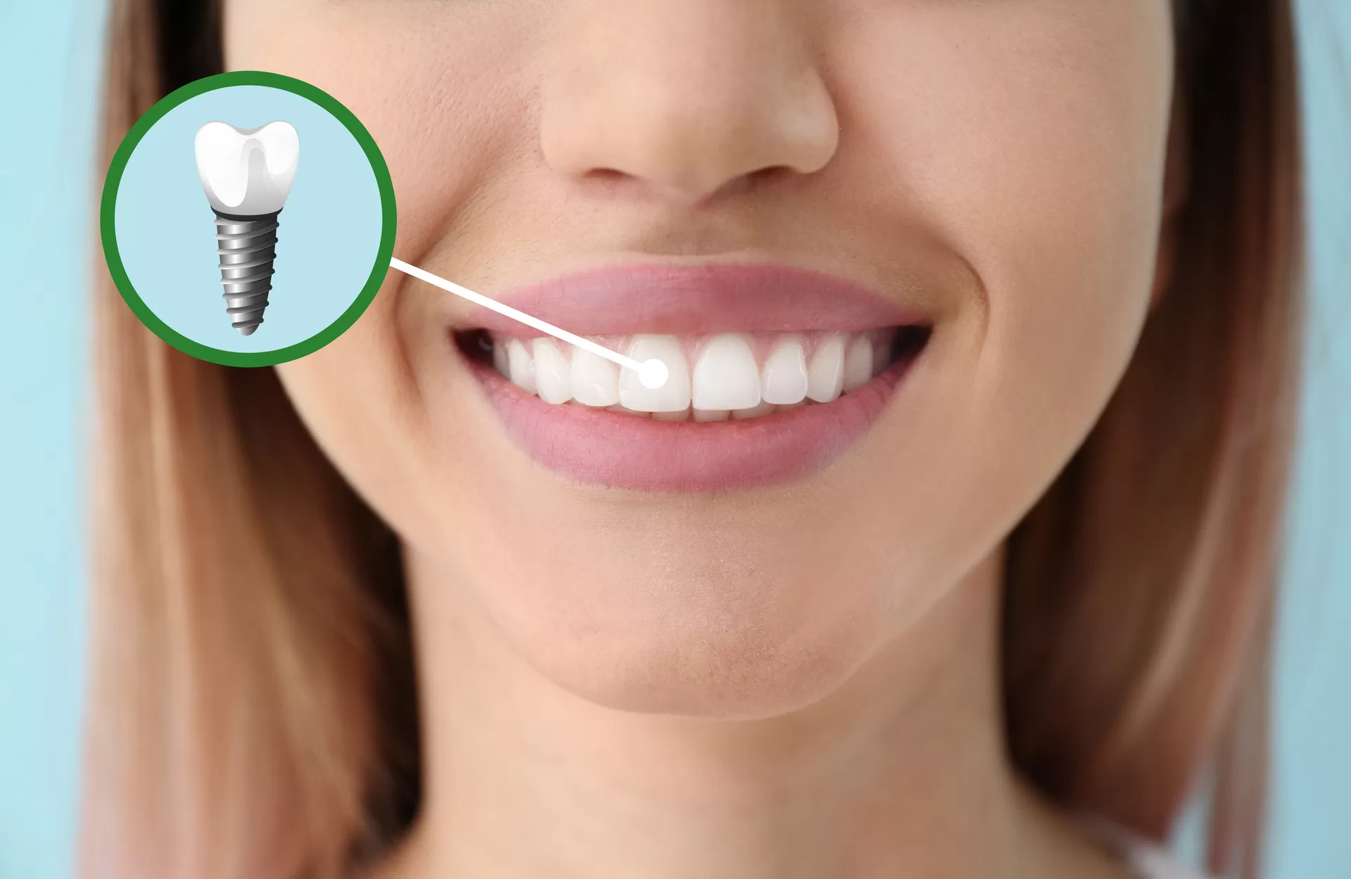 For Healthy Smiles: Health Scape Turkey